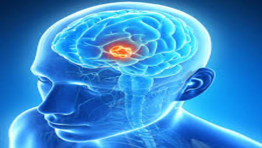 brain-tumor-surgery-in-india